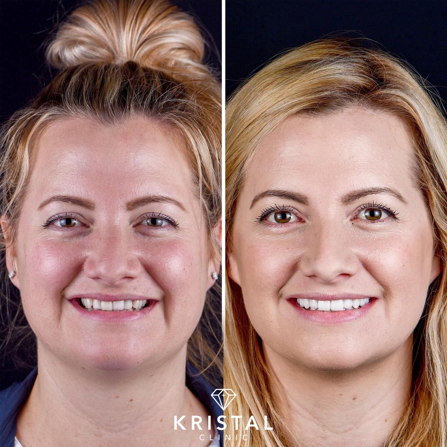 Kristal Clinic - Kristal Clinic