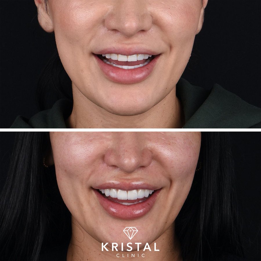 Kristal Clinic - Kristal Clinic