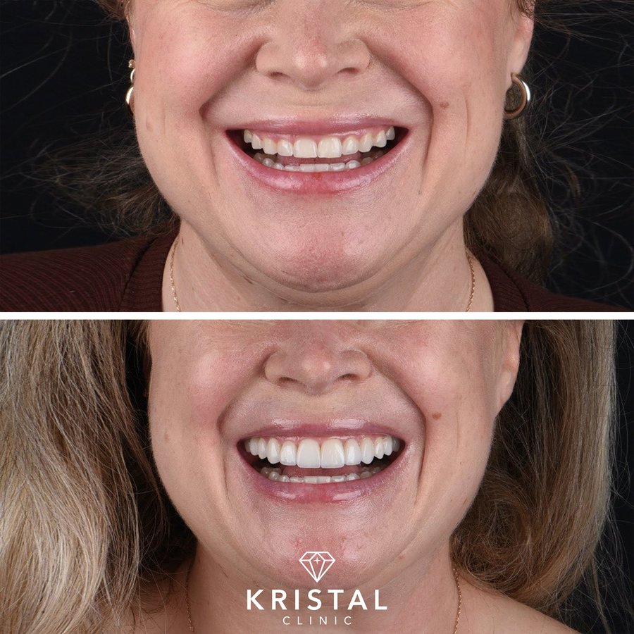 Kristal Clinic - Kristal Clinic