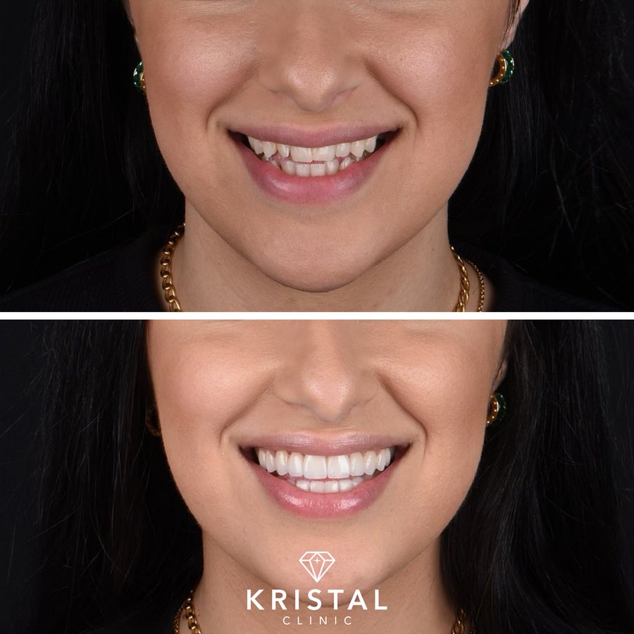 Kristal Clinic - Kristal Clinic