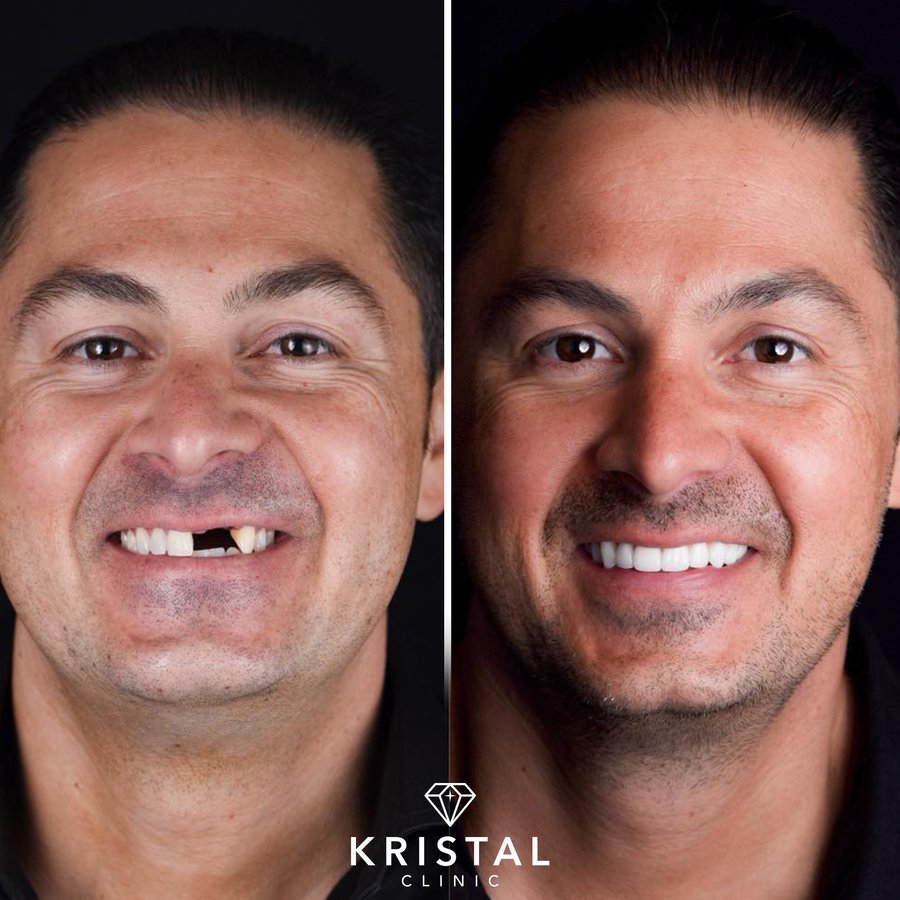 Kristal Clinic - Kristal Clinic