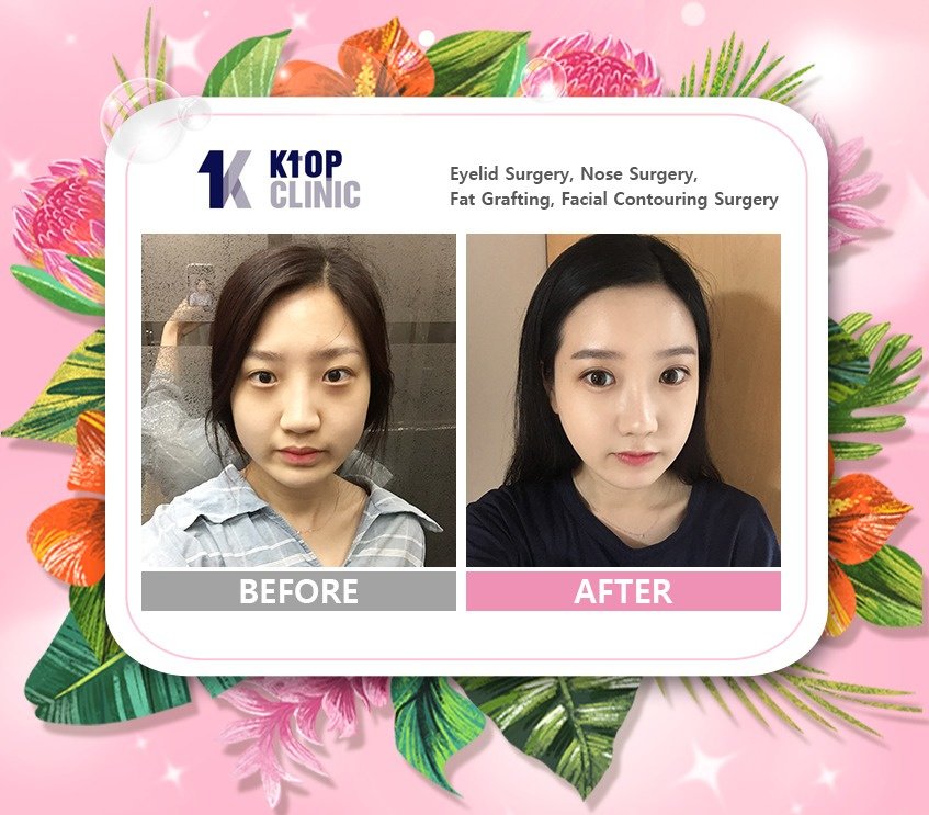 K-Top Clinic - K-Top Clinic