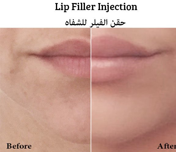 La Beaute Medical Centre, Derma & Aesthetic - La Beaute Medical Centre, Derma & Aesthetic