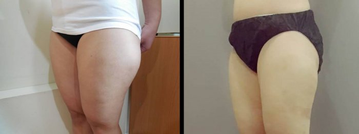 La Grace Clinic - Central World - La Grace Clinic - Central World