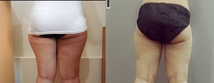 La Grace Clinic - Central World - La Grace Clinic - Central World