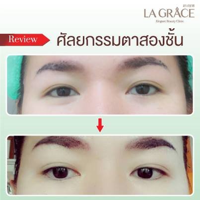 La Grace Clinic - Central World - La Grace Clinic - Central World