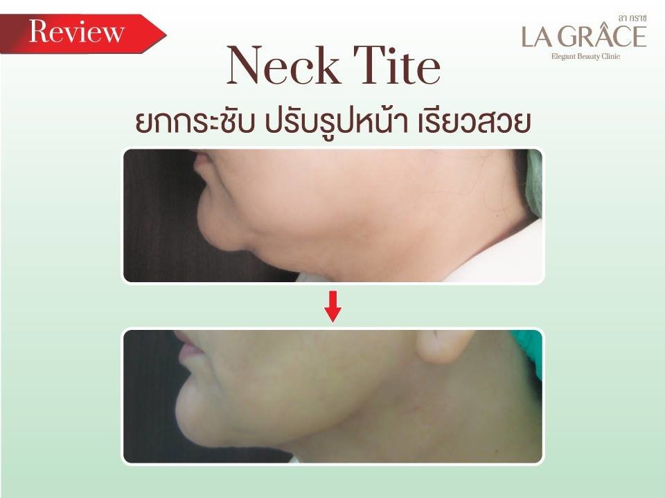 La Grace Clinic - Central World - La Grace Clinic - Central World