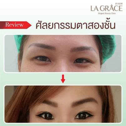 La Grace Clinic - Central World - La Grace Clinic - Central World