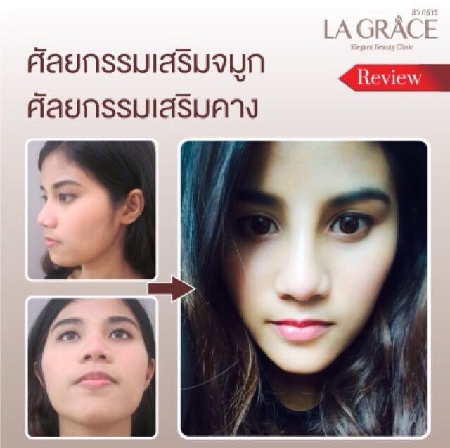 La Grace Clinic - Central World - La Grace Clinic - Central World