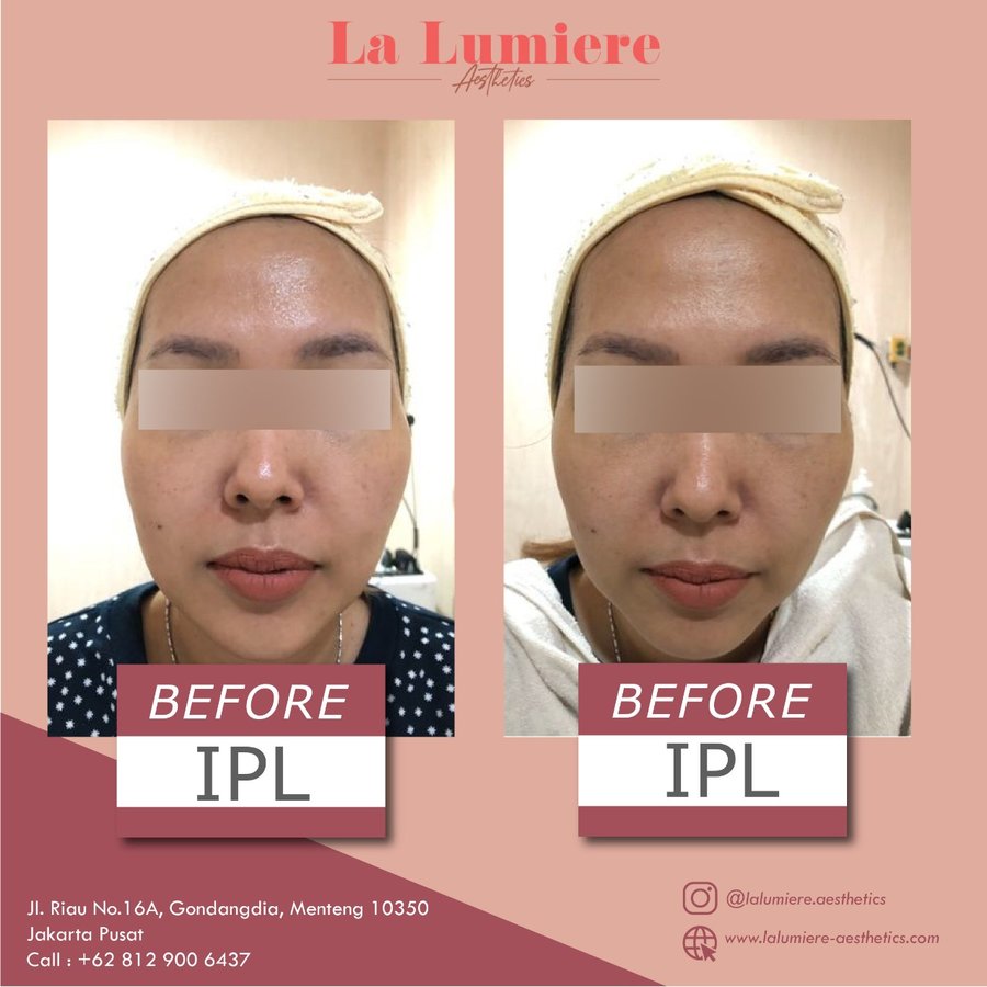 La Lumiere Aesthetics - La Lumiere Aesthetics