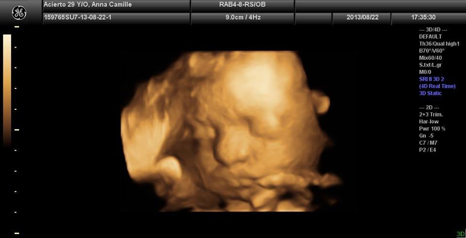 Lagro OB Gyn Ultrasound Clinic - Lagro OB Gyn Ultrasound Clinic