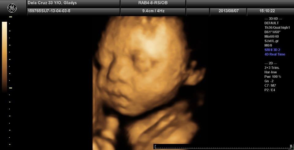 Lagro OB Gyn Ultrasound Clinic - Lagro OB Gyn Ultrasound Clinic