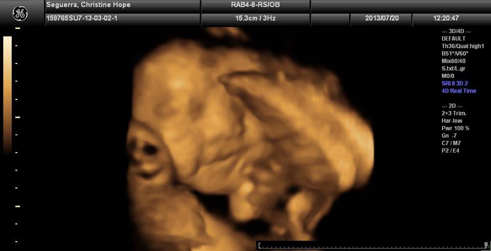 Lagro OB Gyn Ultrasound Clinic - Lagro OB Gyn Ultrasound Clinic