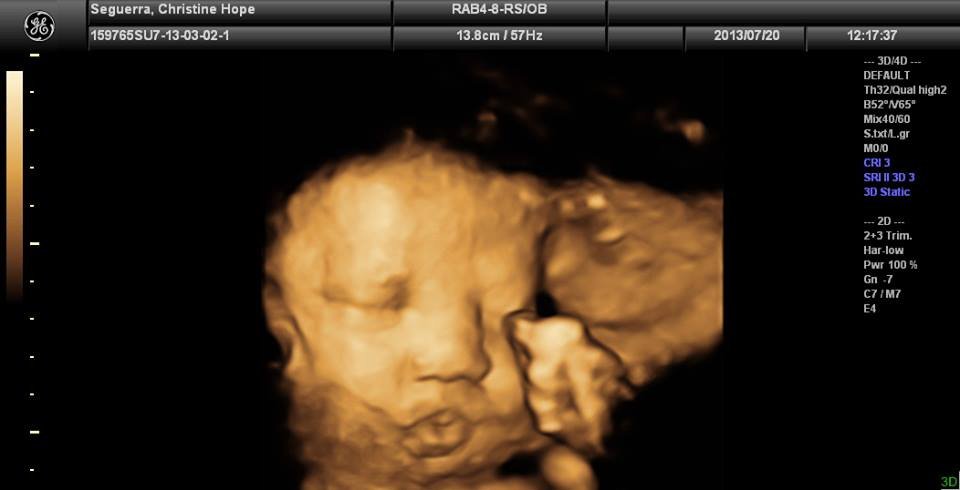 Lagro OB Gyn Ultrasound Clinic - Lagro OB Gyn Ultrasound Clinic