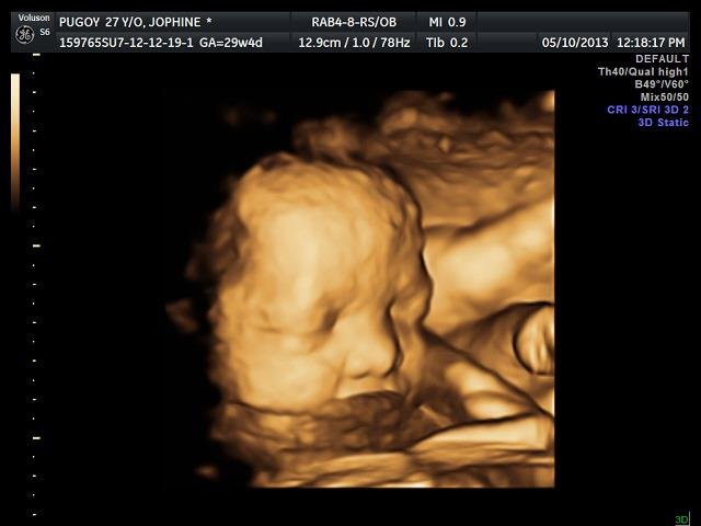 Lagro OB Gyn Ultrasound Clinic - Lagro OB Gyn Ultrasound Clinic