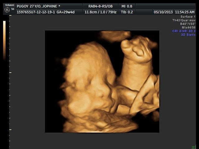 Lagro OB Gyn Ultrasound Clinic - Lagro OB Gyn Ultrasound Clinic