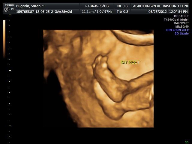 Lagro OB Gyn Ultrasound Clinic - Lagro OB Gyn Ultrasound Clinic