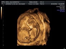 Lagro OB Gyn Ultrasound Clinic - Lagro OB Gyn Ultrasound Clinic