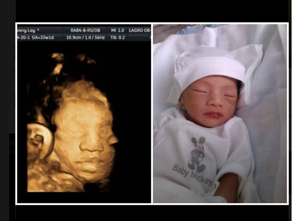 Lagro OB Gyn Ultrasound Clinic - Lagro OB Gyn Ultrasound Clinic