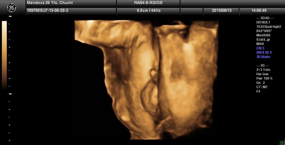 Lagro OB Gyn Ultrasound Clinic - Lagro OB Gyn Ultrasound Clinic