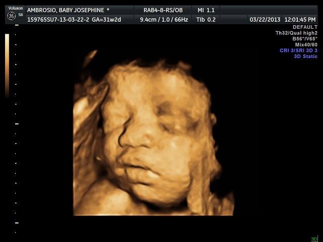 Lagro OB Gyn Ultrasound Clinic - Lagro OB Gyn Ultrasound Clinic