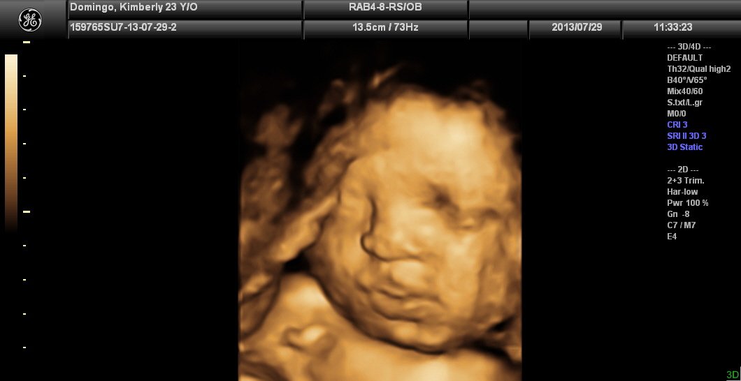 Lagro OB Gyn Ultrasound Clinic - Lagro OB Gyn Ultrasound Clinic