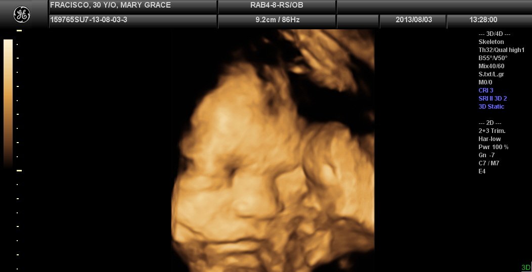 Lagro OB Gyn Ultrasound Clinic - Lagro OB Gyn Ultrasound Clinic