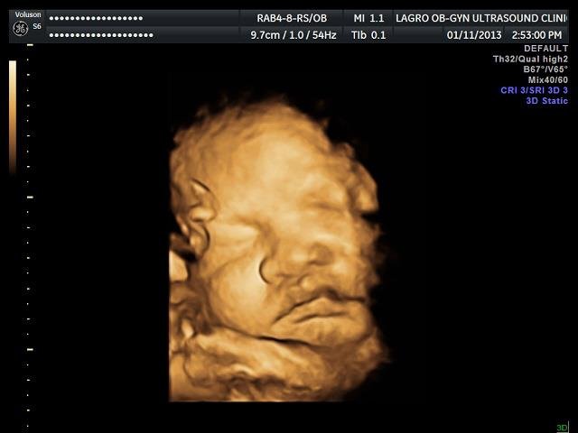 Lagro OB Gyn Ultrasound Clinic - Lagro OB Gyn Ultrasound Clinic