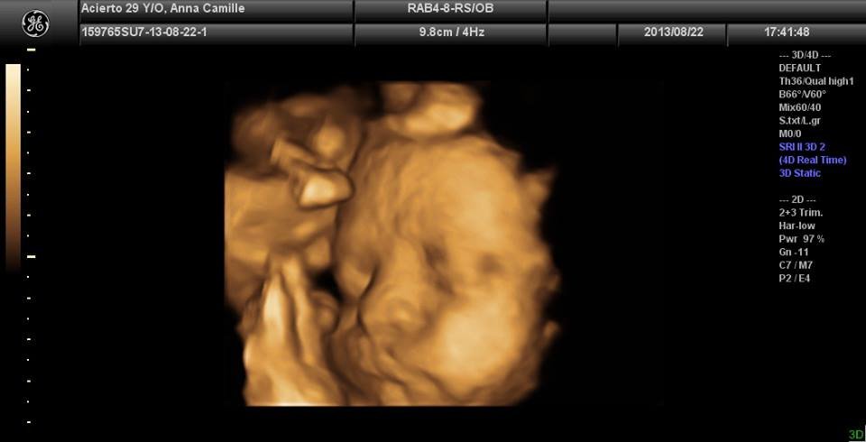 Lagro OB Gyn Ultrasound Clinic - Lagro OB Gyn Ultrasound Clinic