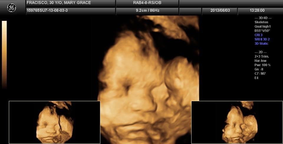 Lagro OB Gyn Ultrasound Clinic - Lagro OB Gyn Ultrasound Clinic