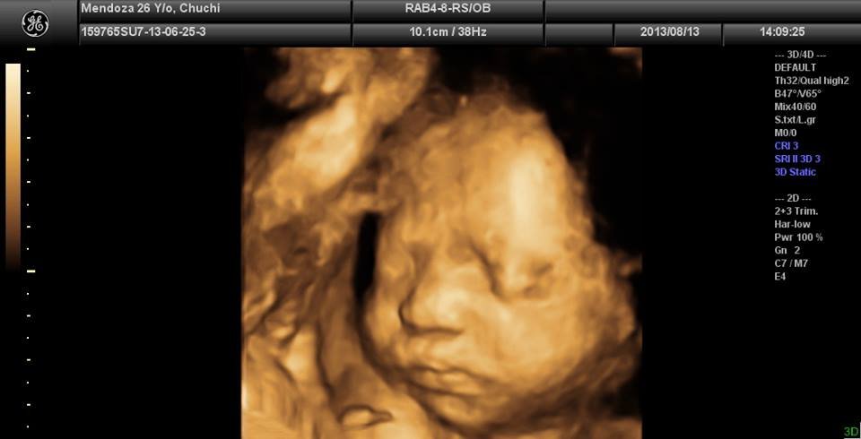 Lagro OB Gyn Ultrasound Clinic - Lagro OB Gyn Ultrasound Clinic