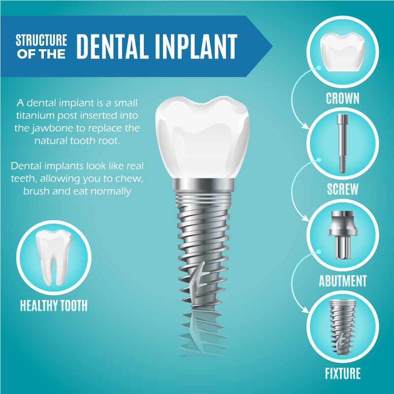 Lakefront Family Dental - Lakefront Family Dental