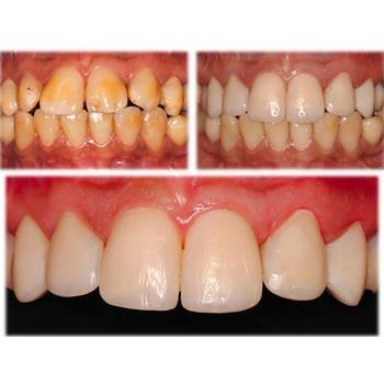 Lalitha Dental Care - Lalitha Dental Care