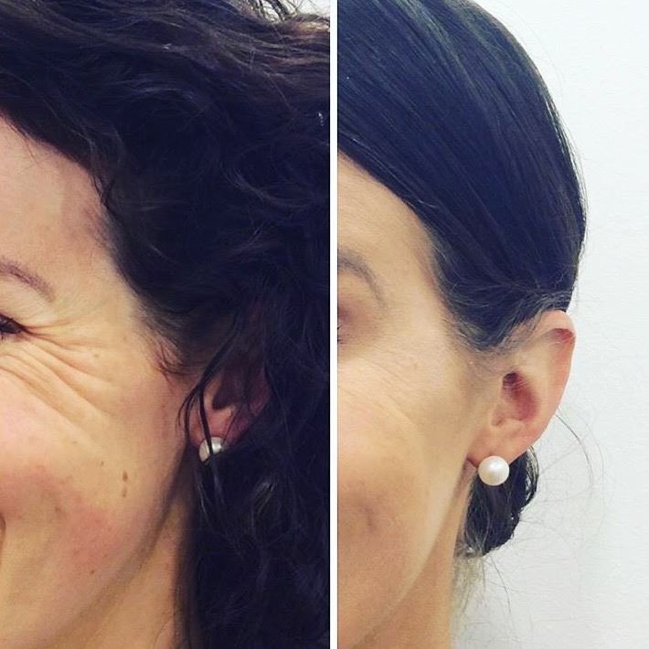 Laser Clinics Australia - Kotara Westfield - Laser Clinics Australia - Kotara Westfield