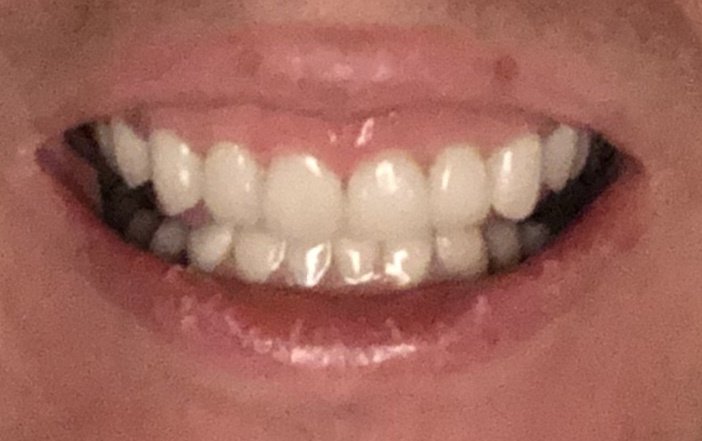 Laser Dental Clinic Marrakech - Laser Dental Clinic Marrakech