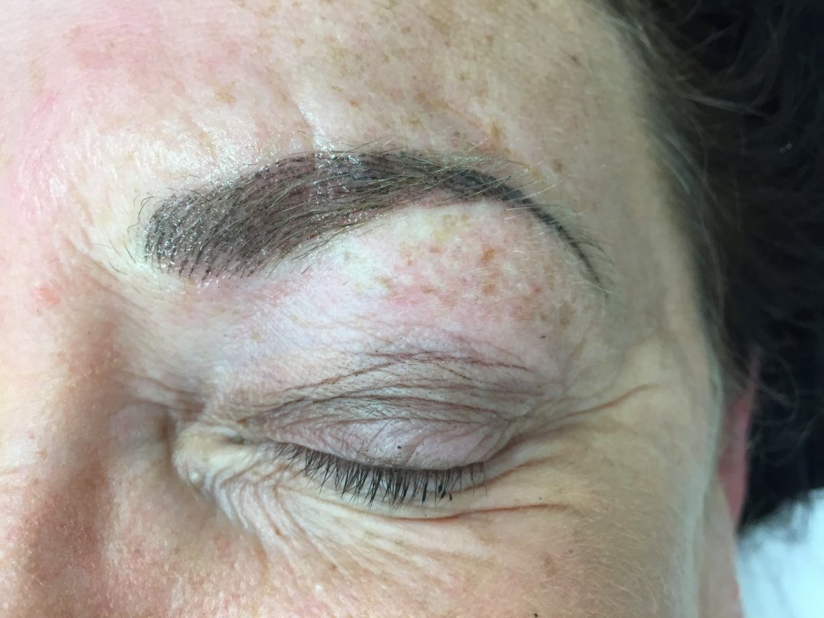 Laser Express Beauty - Laser Express Beauty