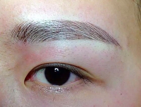 Laser Express Beauty - Laser Express Beauty