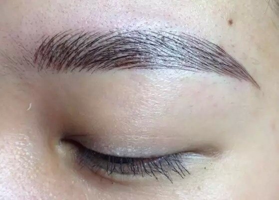 Laser Express Beauty - Laser Express Beauty