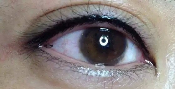 Laser Express Beauty - Laser Express Beauty