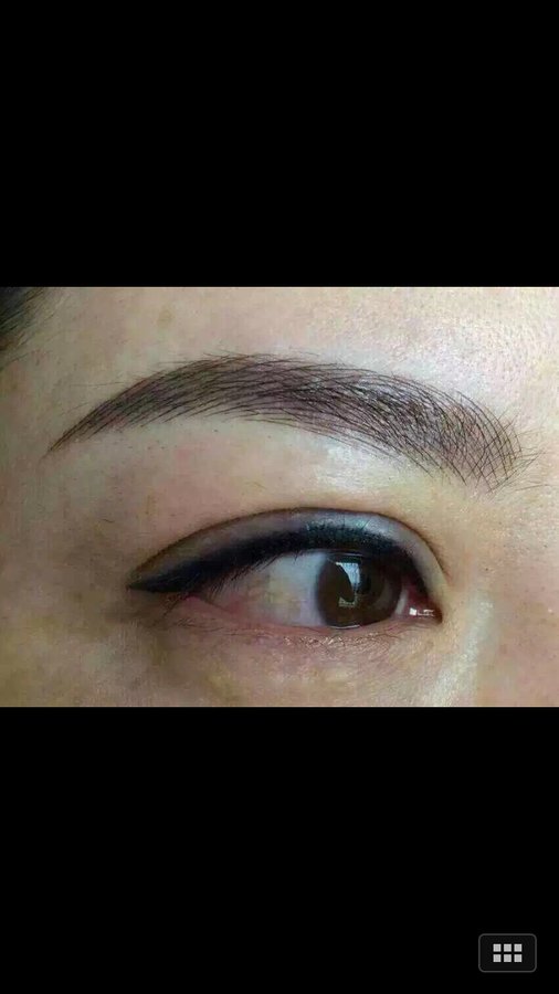 Laser Express Beauty - Laser Express Beauty