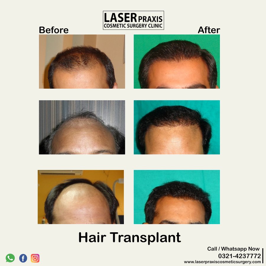 Laser Praxis Cosmetic Surgery & Liposuction Clinic - Laser Praxis Cosmetic Surgery & Liposuction Clinic