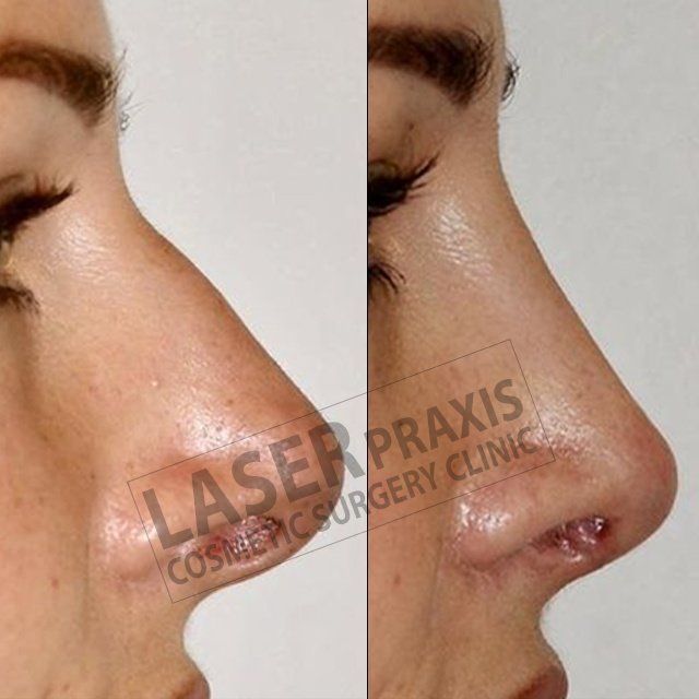 Laser Praxis Cosmetic Surgery & Liposuction Clinic - Laser Praxis Cosmetic Surgery & Liposuction Clinic