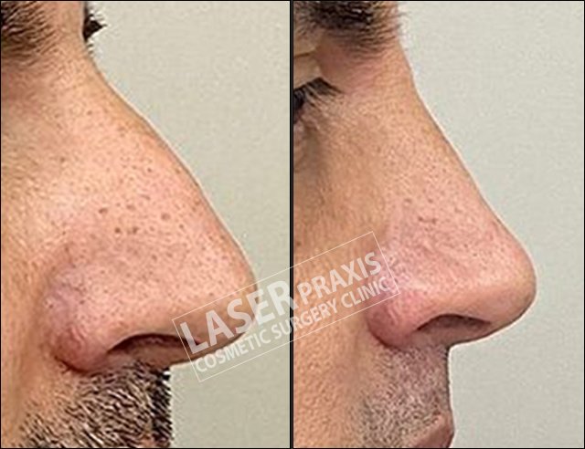 Laser Praxis Cosmetic Surgery & Liposuction Clinic - Laser Praxis Cosmetic Surgery & Liposuction Clinic