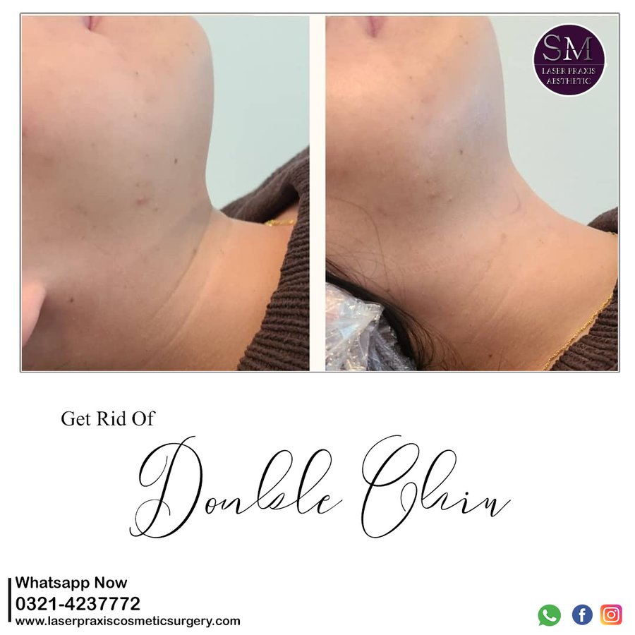 Laser Praxis Cosmetic Surgery & Liposuction Clinic - Laser Praxis Cosmetic Surgery & Liposuction Clinic