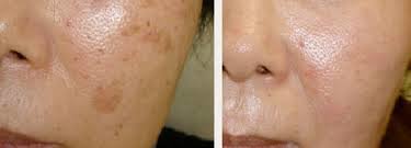 Laser Skin Clinics - Laser Skin Clinics