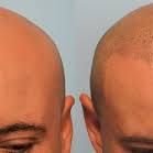 Laser Skin Clinics - Laser Skin Clinics