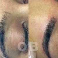 Laser Skin Clinics - Laser Skin Clinics