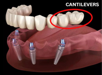 LBR DENTAL & IMPLANT CENTER - LBR DENTAL & IMPLANT CENTER