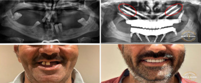 LBR DENTAL & IMPLANT CENTER - LBR DENTAL & IMPLANT CENTER