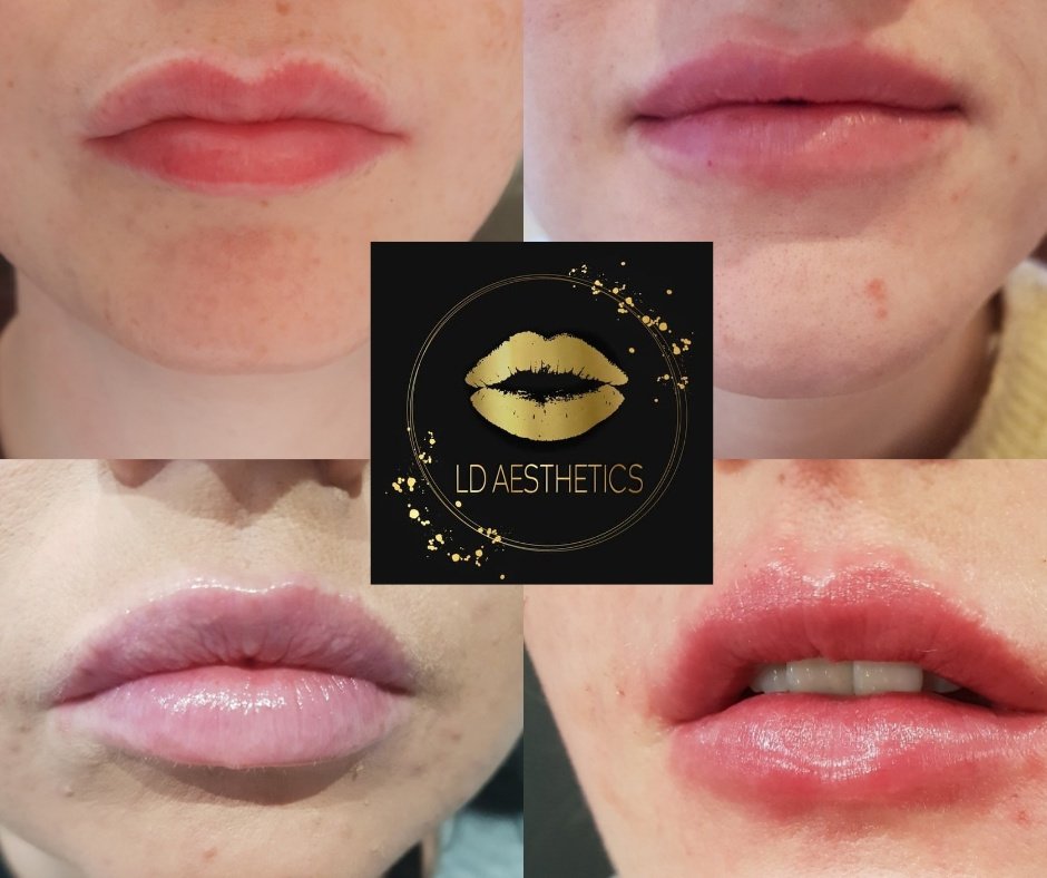 LD جماليات - LD Aesthetics